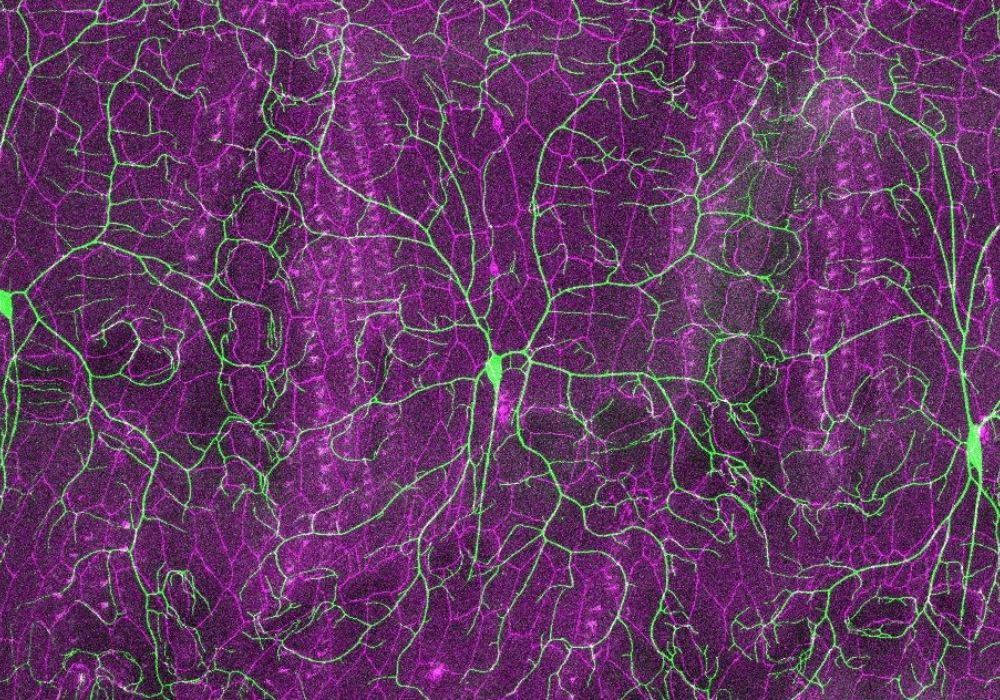 UC Irvine Study Reveals How Damaged Tissue Can Limit Nerve Cell Repair